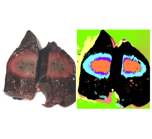 Liver treated with RF ablation (RGB image LHS, logistic regression analysis false color on RHS)